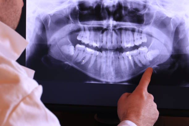 Best Tooth Infection Emergency Dentist  in North Laurel, MD