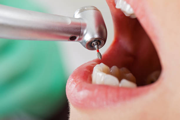 Best Dentist for Tooth Abscess  in North Laurel, MD